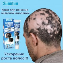 Крем от алопеции, активатор роста волос SUMIFUN