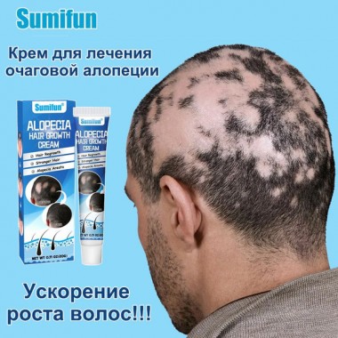 Крем от алопеции, активатор роста волос SUMIFUN