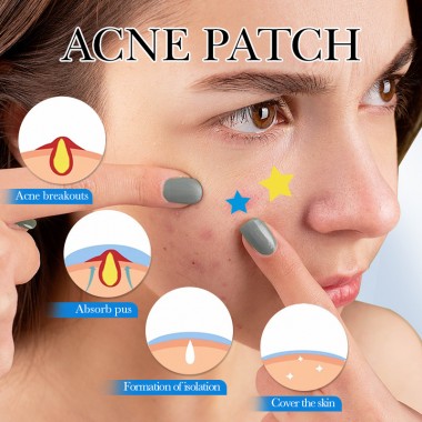 SADOER Патчи для проблемной кожи лица от прыщей ACNE PATCH, 75 шт